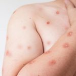 “Guerra da Carne” recupera duas toneladas de carga saqueada após tombamento na MT-235