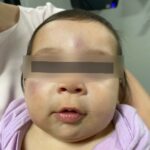 Delegado detalha investigação que levou à prisão de babá suspeita de torturar bebê em Gaúcha do Norte